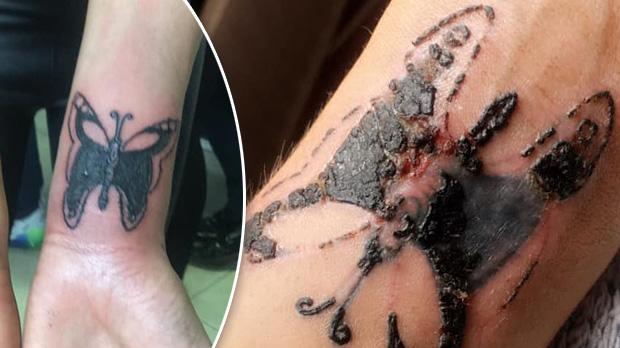 Woman Left With Hole In Her Wrist After Botched Tattoo