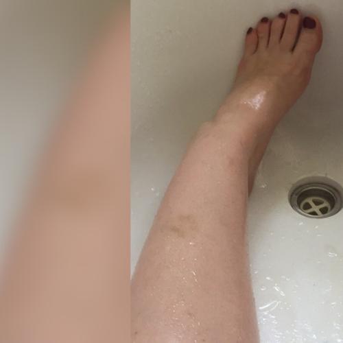 Aussie Woman Stuck in Bath After Using Beauty Product