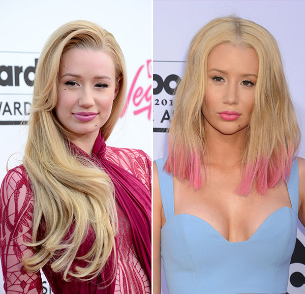 Has Iggy Azalea Had More Plastic Surgery