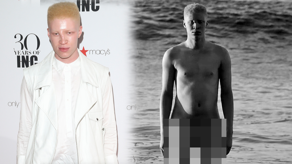 Albino Men | Gay Fetish XXX