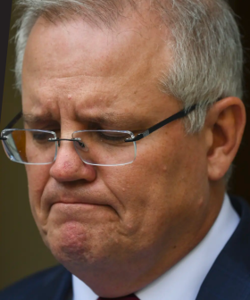 Was This Too Far? ScoMo Gets Burned On Live Radio About Hair Loss!