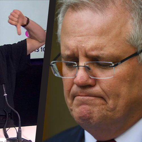 Was This Too Far? ScoMo Gets Burned On Live Radio About Hair Loss!