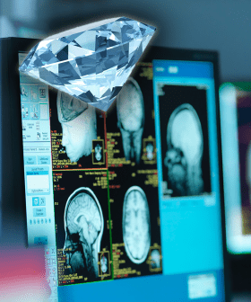 Melbourne Researchers Have Developed A Diamond Laser That Targets Brain Disorders