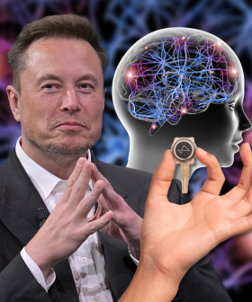 Elon Musk Is Looking For Volunteers To Trial His New Brain Implant